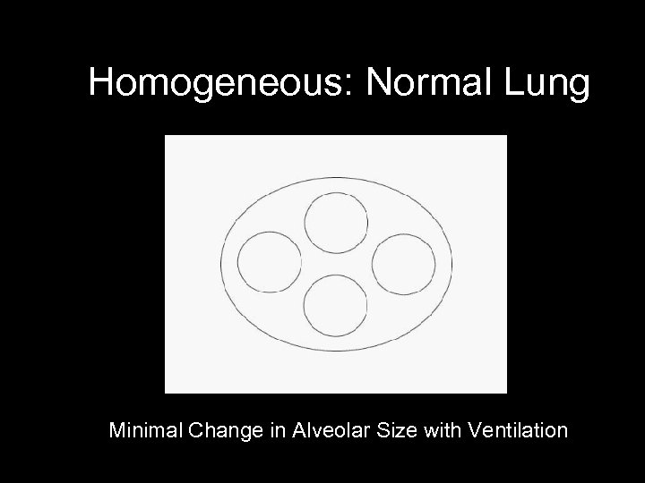 Homogeneous: Normal Lung Minimal Change in Alveolar Size with Ventilation 