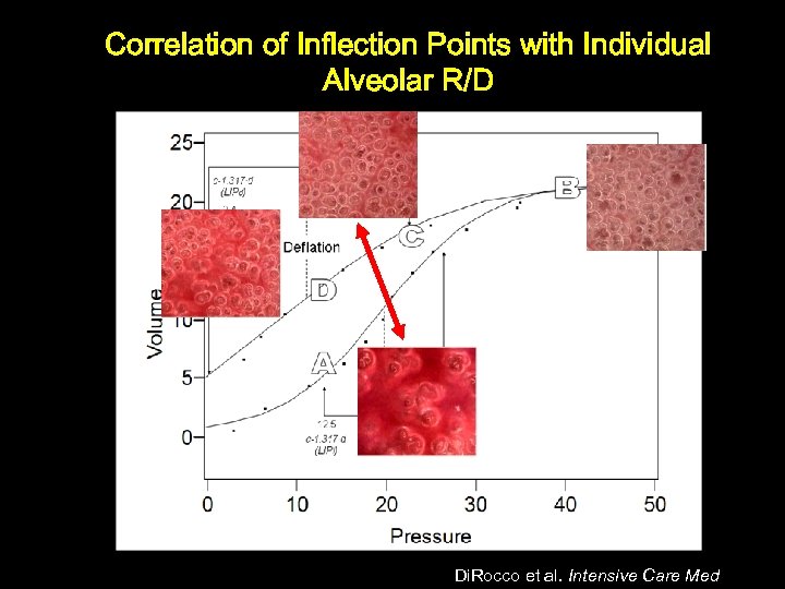 Correlation of Inflection Points with Individual Alveolar R/D Di. Rocco et al. Intensive Care