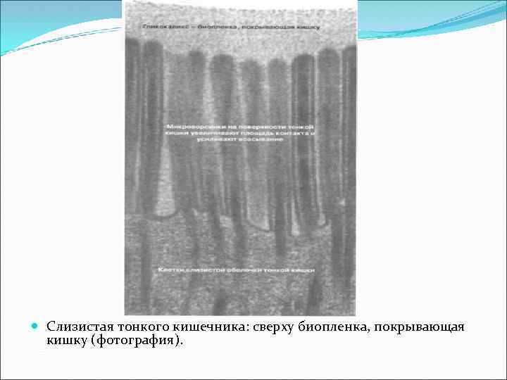  Слизистая тонкого кишечника: сверху биопленка, покрывающая кишку (фотография). 