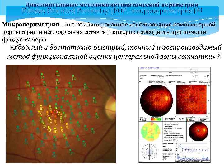 Дополнительные методики автоматической периметрии Fundus Oriented Perimetry (FOP, микропериметрия)[1] Микропериметрия – это комбинированное использование