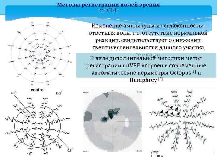 Методы регистрации полей зрения mf. VEP Изменение амплитуды и «сглаженность» ответных волн, т. е.