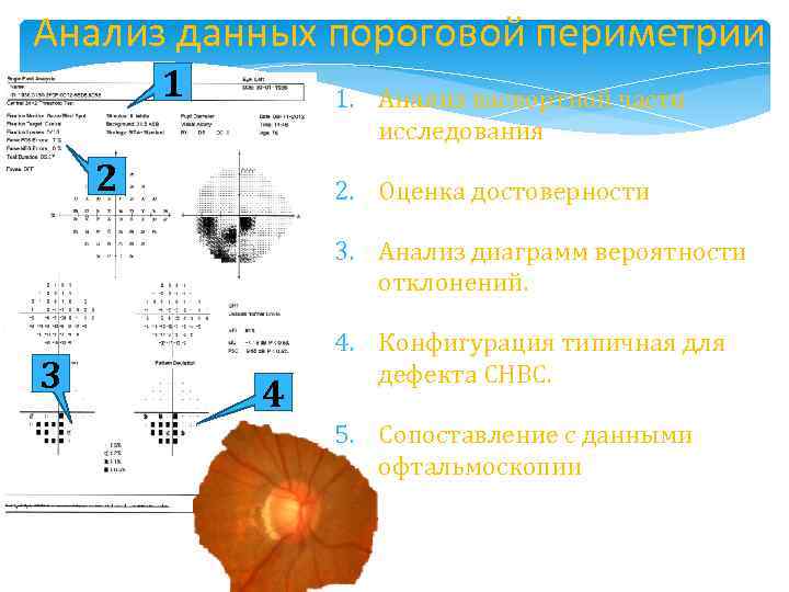 Анализ данных пороговой периметрии 1 1. Анализ паспортной части исследования 2 2. Оценка достоверности