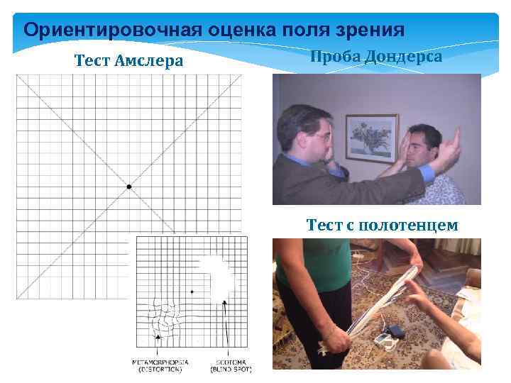 Ориентировочная оценка поля зрения Тест Амслера Проба Дондерса Тест с полотенцем 