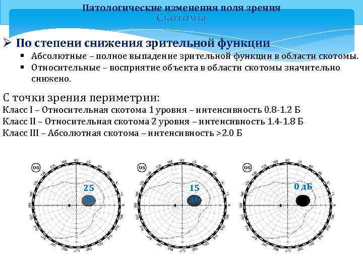 Патологические изменения поля зрения Скотомы Ø По степени снижения зрительной функции § Абсолютные –