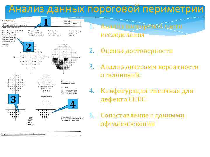 Анализ данных пороговой периметрии 1 1. Анализ паспортной части исследования 2 2. Оценка достоверности