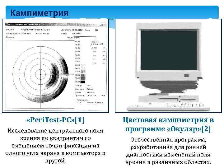 Кампиметрия «Peri. Test-PC» [1] Исследование центрального поля зрения по квадрантам со смещением точки фиксации