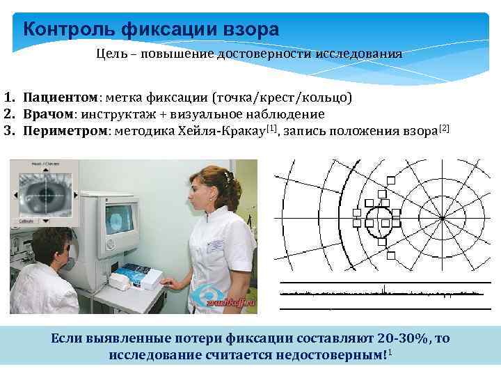 Контроль фиксации взора Цель – повышение достоверности исследования 1. Пациентом: метка фиксации (точка/крест/кольцо) 2.