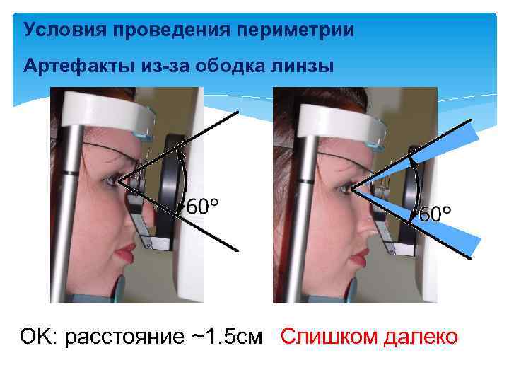 Условия проведения периметрии Артефакты из-за ободка линзы OK: расстояние ~1. 5 см Слишком далеко