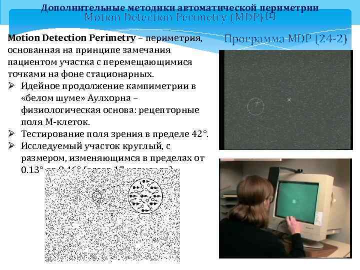 Дополнительные методики автоматической периметрии Motion Detection Perimetry (MDP) [1] Motion Detection Perimetry – периметрия,