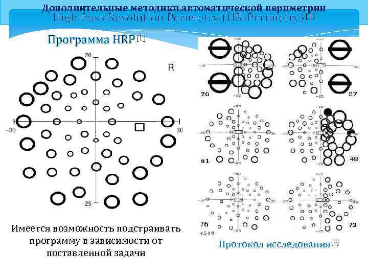 Дополнительные методики автоматической периметрии High-Pass Resolution Perimetry (HR-Perimetry)[1] Программа HRP[1] Имеется возможность подстраивать программу