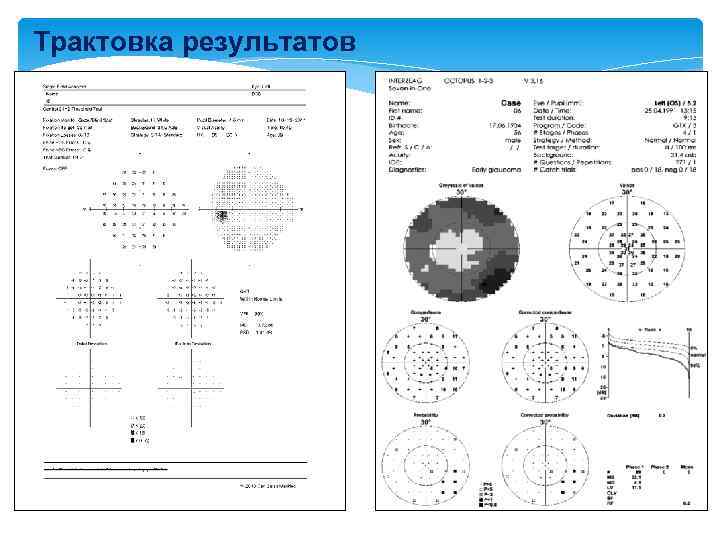 Трактовка результатов 