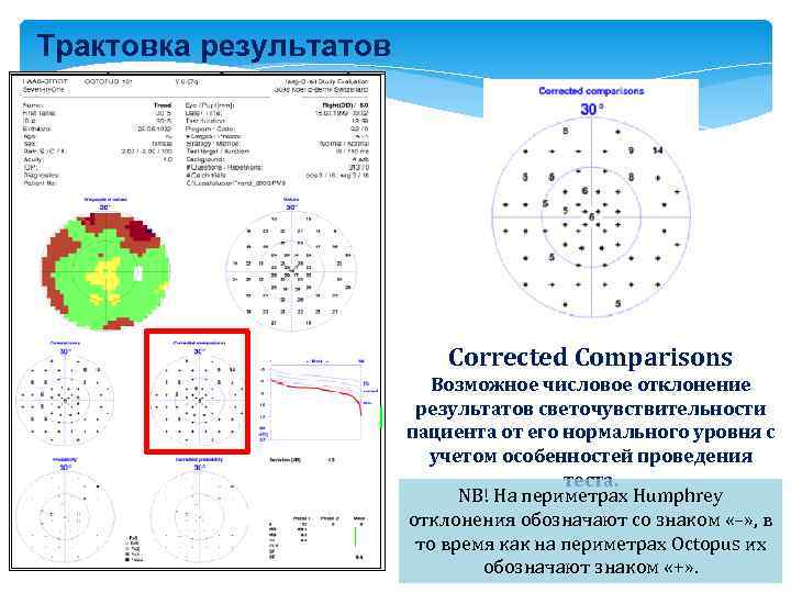 Трактовка результатов Corrected Comparisons Возможное числовое отклонение результатов светочувствительности пациента от его нормального уровня