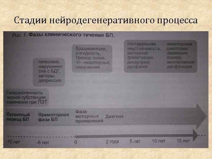 Стадии нейродегенеративного процесса 