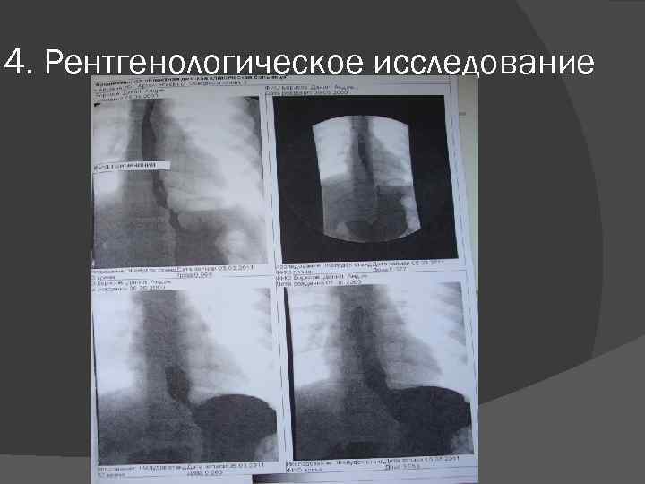 4. Рентгенологическое исследование 