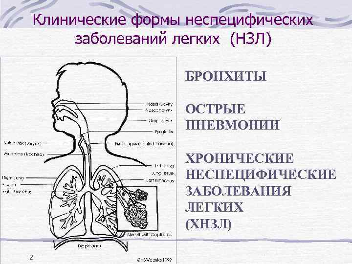Клинические формы неспецифических заболеваний легких (НЗЛ) БРОНХИТЫ ОСТРЫЕ ПНЕВМОНИИ ХРОНИЧЕСКИЕ НЕСПЕЦИФИЧЕСКИЕ ЗАБОЛЕВАНИЯ ЛЕГКИХ (ХНЗЛ)