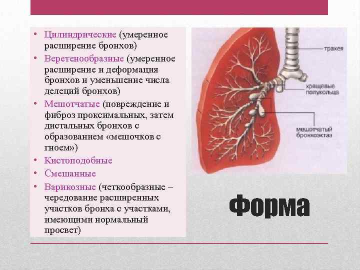  • Цилиндрические (умеренное расширение бронхов) • Веретенообразные (умеренное расширение и деформация бронхов и