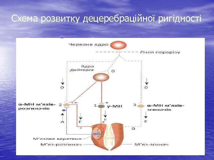 Схема розвитку децеребраційної ригідності 