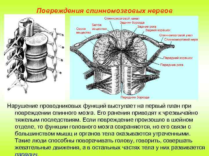 Повреждения спинномозговых нервов Нарушение проводниковых функций выступает на первый план при повреждении спинного мозга.