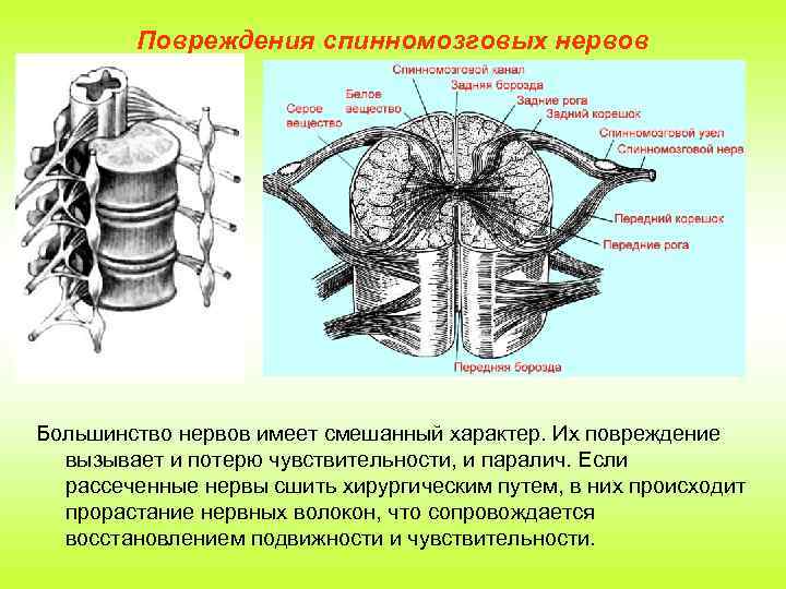 Повреждения спинномозговых нервов Большинство нервов имеет смешанный характер. Их повреждение вызывает и потерю чувствительности,