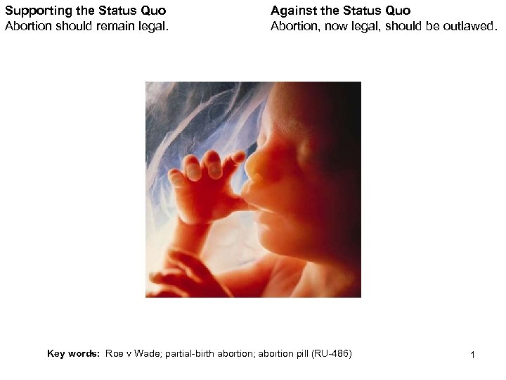 Supporting the Status Quo Abortion should remain legal. Against the Status Quo Abortion, now