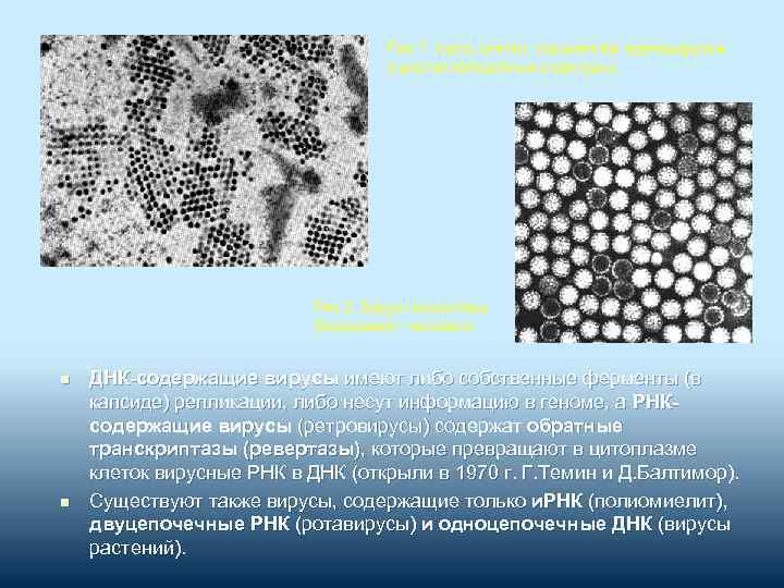 Рис. 1. Часть клетки, зараженной аденовирусом (кристаллоподобные структуры) Рис. 2. Вирус папилломы (бородавки) человека