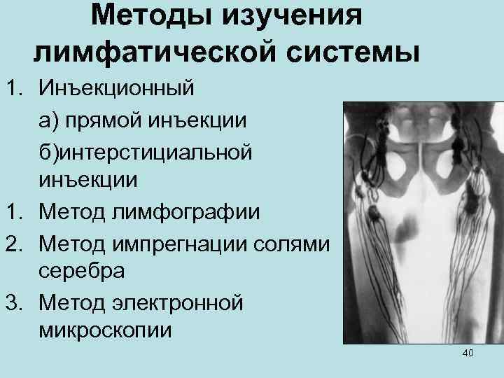 Методы изучения лимфатической системы 1. Инъекционный а) прямой инъекции б)интерстициальной инъекции 1. Метод лимфографии