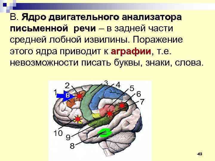 В. Ядро двигательного анализатора письменной речи – в задней части средней лобной извилины. Поражение