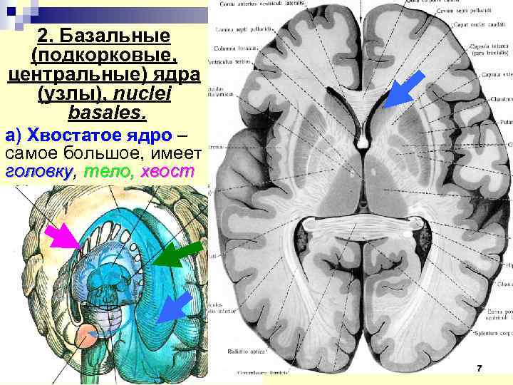 Головка хвостатого ядра образует стенку