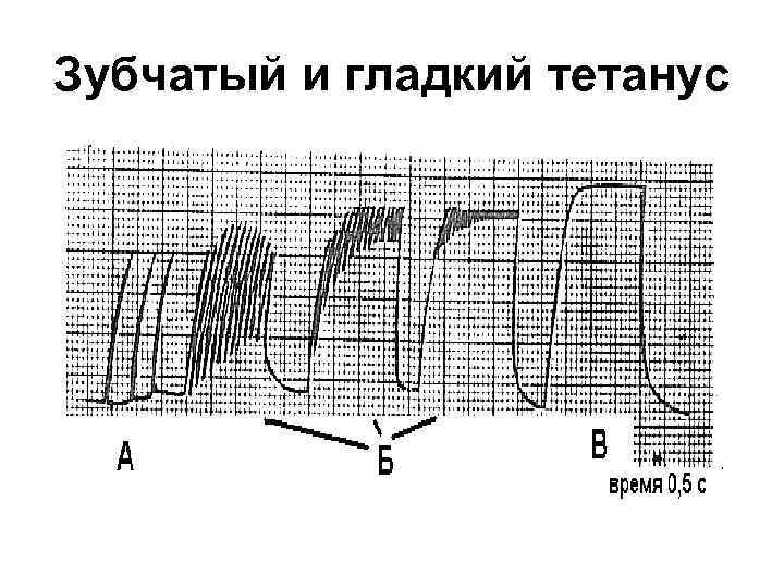 Зубчатый и гладкий тетанус 