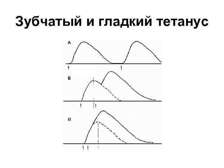 Зубчатый и гладкий тетанус 