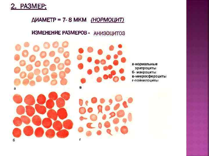 2. РАЗМЕР: ДИАМЕТР = 7 - 8 МКМ (НОРМОЦИТ) ИЗМЕНЕНИЕ РАЗМЕРОВ - 