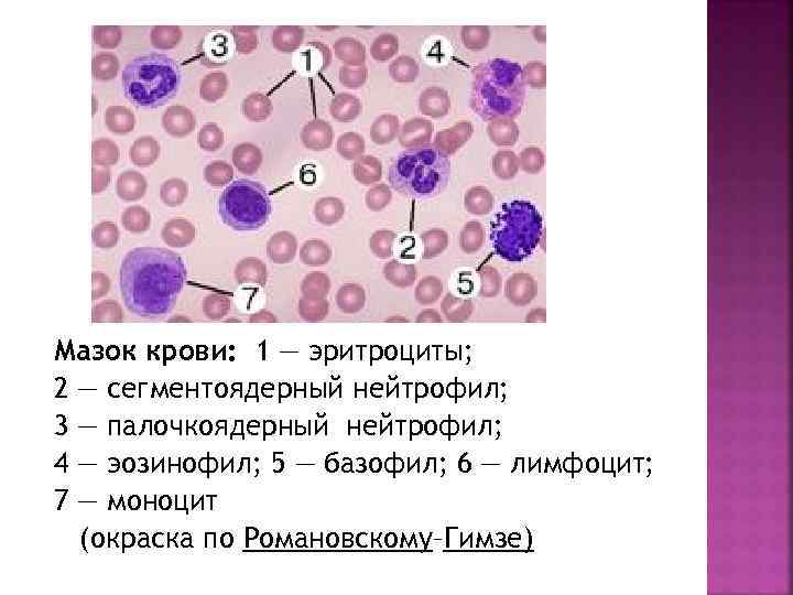 Мазок крови: 1 — эритроциты; 2 — сегментоядерный нейтрофил; 3 — палочкоядерный нейтрофил; 4