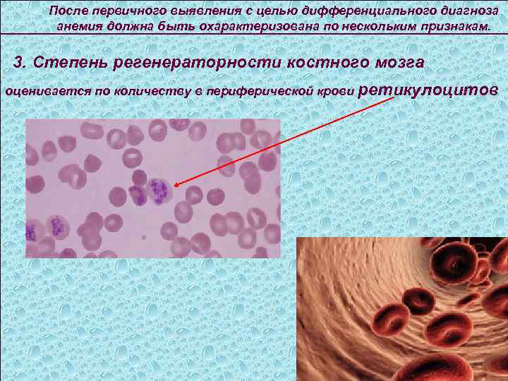 После первичного выявления с целью дифференциального диагноза анемия должна быть охарактеризована по нескольким признакам.