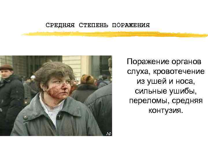 СРЕДНЯЯ СТЕПЕНЬ ПОРАЖЕНИЯ Поражение органов слуха, кровотечение из ушей и носа, сильные ушибы, переломы,