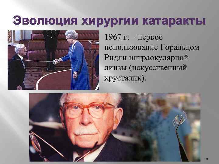 Эволюция хирургии катаракты 1967 г. – первое использование Горальдом Ридли интраокулярной линзы (искусственный хрусталик).