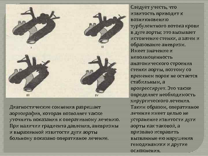Диагностические сомнения разрешает аортография, которая позволяет также уточнить показания к оперативному лечению. При наличии