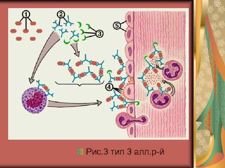Рис. 3 тип 3 алл. р-й 