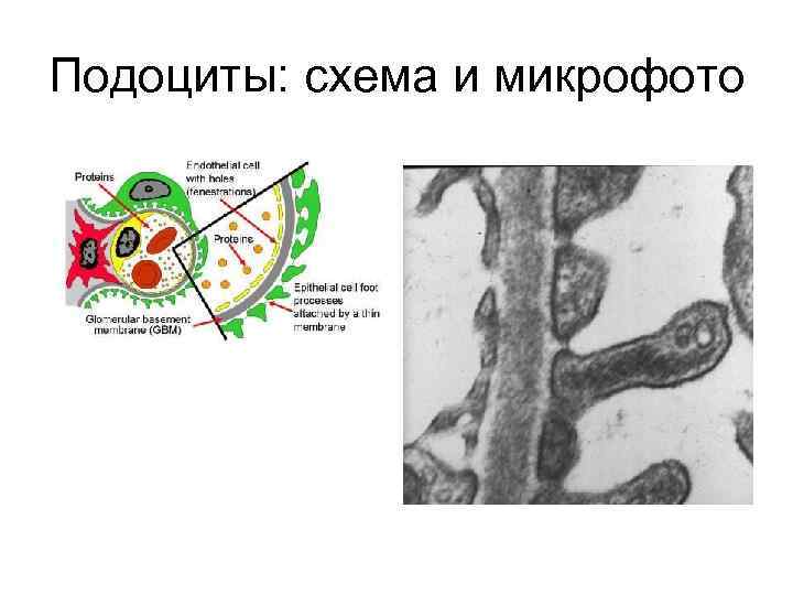 Подоциты: схема и микрофото 