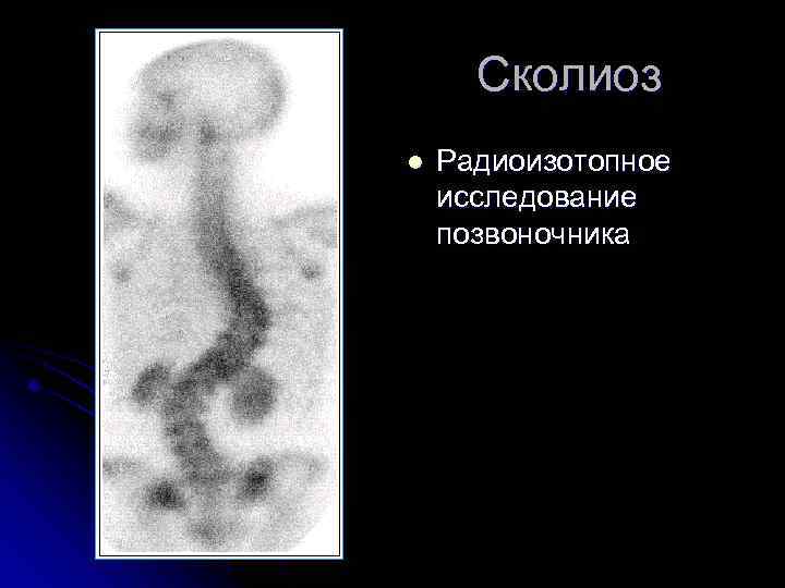 Лучевая диагностика позвоночник презентация