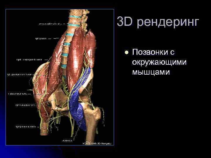 3 D рендеринг l Позвонки с окружающими мышцами 