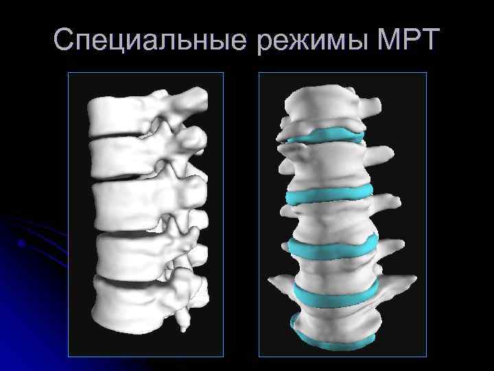 Специальные режимы МРТ 