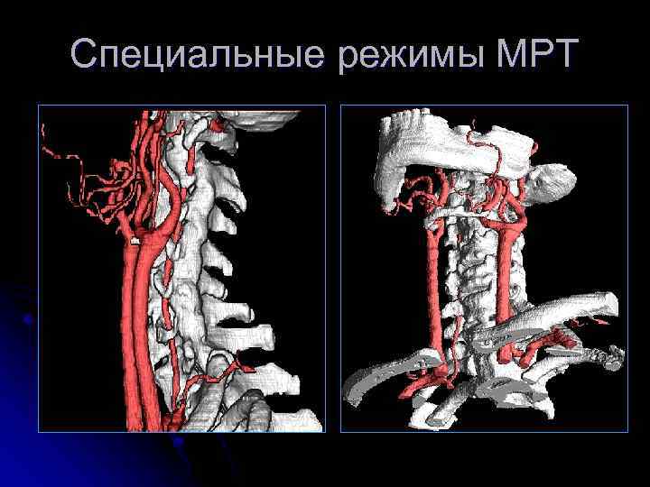 Специальные режимы МРТ 