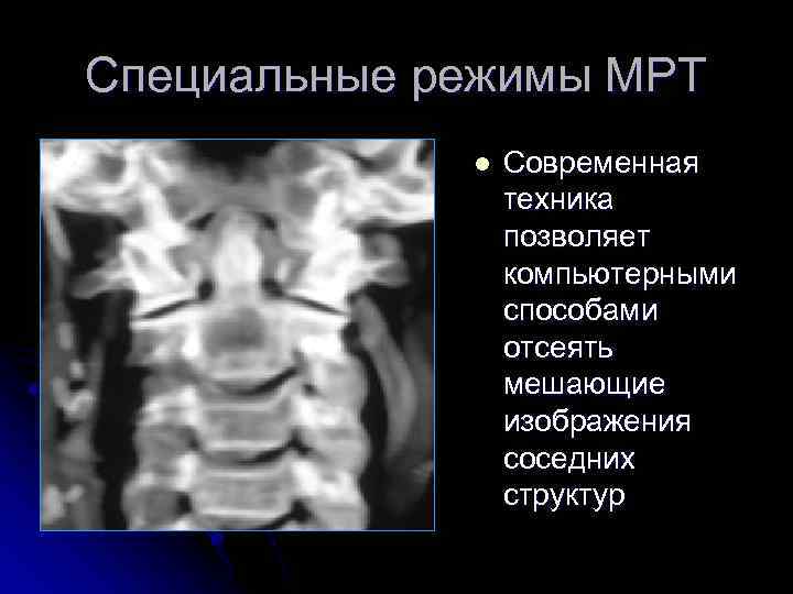 Специальные режимы МРТ l Современная техника позволяет компьютерными способами отсеять мешающие изображения соседних структур