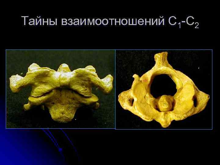 Тайны взаимоотношений С 1 -С 2 