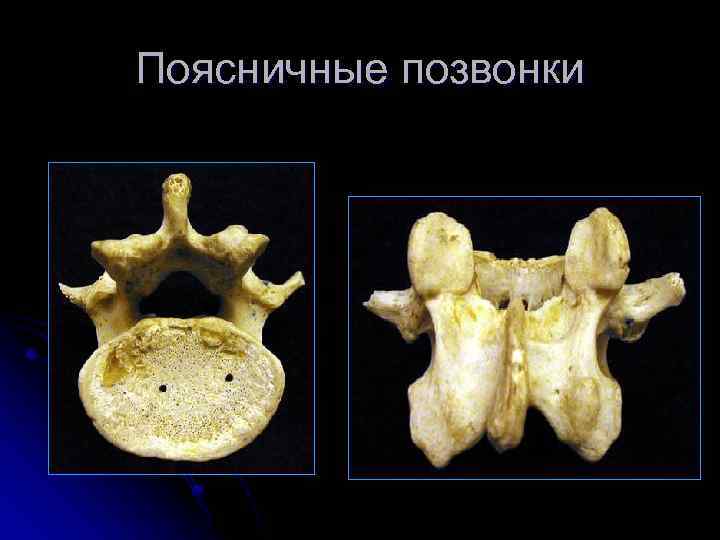 Поясничные позвонки 