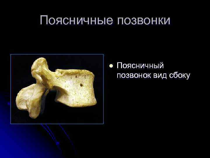 Поясничные позвонки l Поясничный позвонок вид сбоку 