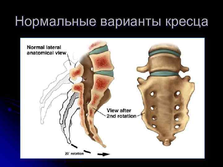 Нормальные варианты кресца 