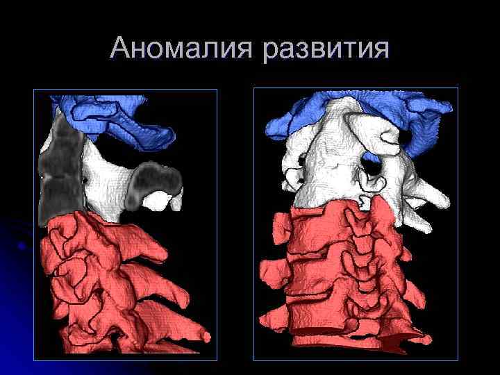 Аномалия развития 