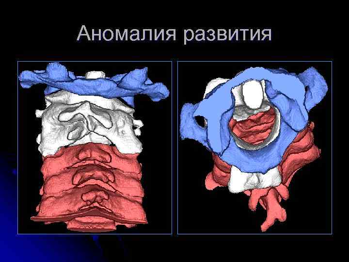 Аномалия развития 