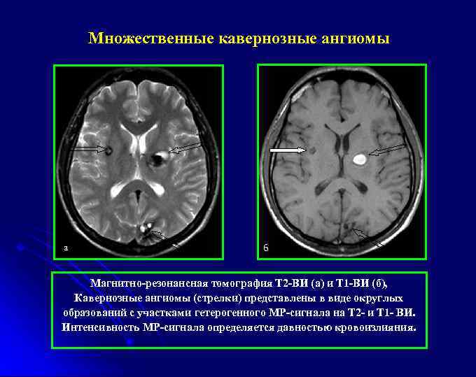 Болезнь фара кт описание